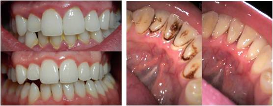 dental general oral hygene